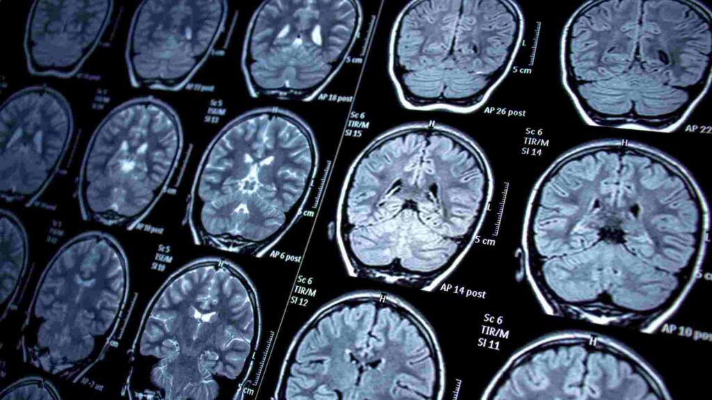 Neurology Services in Dubai